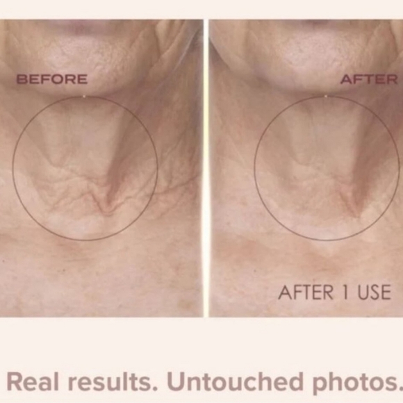 NIP Crêpe Erase Body Serum and Fragrance Free Advanced Body Repair Treatment Set - Picture 13 of 13